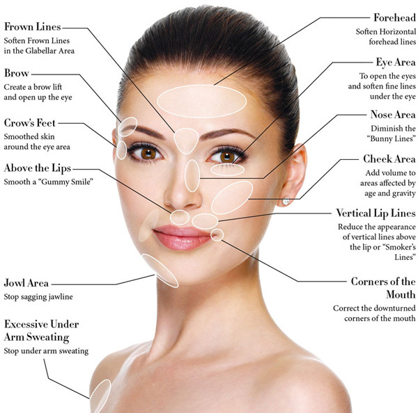 botox injectables