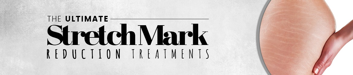 Stretch Marks & Scars Removal Treatment in Marlboro, Manalapan, Freehold,  Monroe & Old Bridge, NJ, Allure MD Spa & Wellness Center