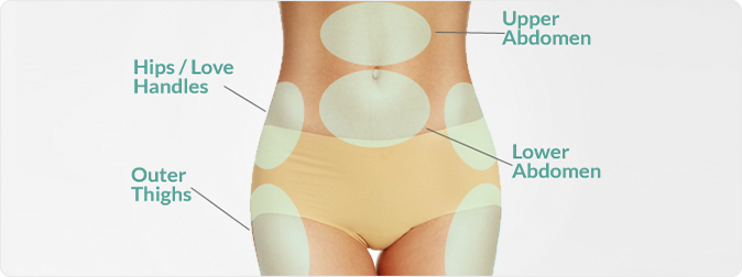 Essex Body Sculpture - STUBBORN GROIN FAT! If you suffer with a stubborn  fatty pad around your groin area (mons pubis) why not have a single fat  freezing treatment to significantly reduce