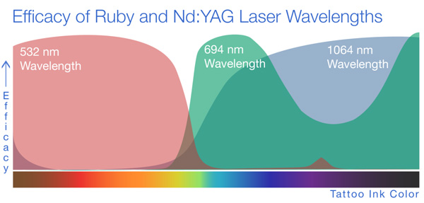 laserRemovalImg2